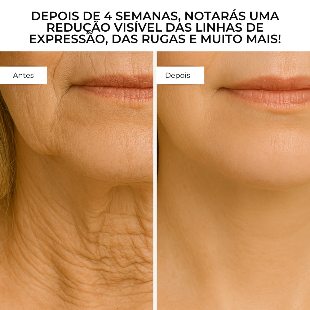 DermaGlow™ – Sistema Avançado de Microinfusão Facial com Ácido Hialurónico